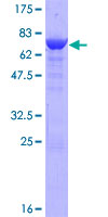 ab164614 on a 12.5% SDS-PAGE stained with Coomassie Blue.