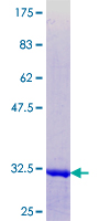 ab164615 on a 12.5% SDS-PAGE stained with Coomassie Blue.