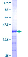 ab161605 on a 12.5% SDS-PAGE stained with Coomassie Blue.