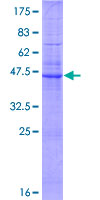 ab152946 on a 12.5% SDS-PAGE stained with Coomassie Blue.