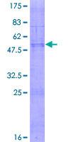ab162459 on a 12.5% SDS-PAGE stained with Coomassie Blue.