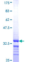 ab162460 on a 12.5% SDS-PAGE stained with Coomassie Blue.