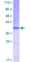 ab152283 on a 12.5% SDS-PAGE stained with Coomassie Blue.