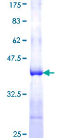 ab160591 on a 12.5% SDS-PAGE stained with Coomassie Blue.