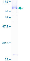 ab158223 on a 12.5% SDS-PAGE stained with Coomassie Blue.