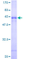 ab161004 on a 12.5% SDS-PAGE stained with Coomassie Blue.