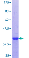 ab161005 on a 12.5% SDS-PAGE stained with Coomassie Blue.