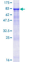 ab165726 on a 12.5% SDS-PAGE stained with Coomassie Blue.