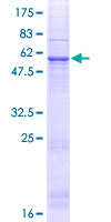 ab166154 on a 12.5% SDS-PAGE stained with Coomassie Blue.