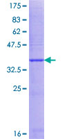 ab165721 on a 12.5% SDS-PAGE stained with Coomassie Blue.