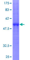 ab162371 on a 12.5% SDS-PAGE stained with Coomassie Blue.
