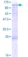 ab153007 on a 12.5% SDS-PAGE stained with Coomassie Blue.