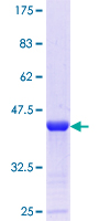 ab153008 on a 12.5% SDS-PAGE stained with Coomassie Blue.