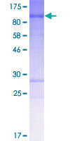 ab164095 on a 12.5% SDS-PAGE stained with Coomassie Blue.