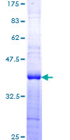 ab152284 on a 12.5% SDS-PAGE stained with Coomassie Blue.