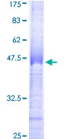 ab152285 on a 12.5% SDS-PAGE stained with Coomassie Blue.