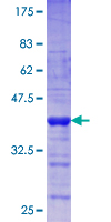 ab153545 on a 12.5% SDS-PAGE stained with Coomassie Blue.