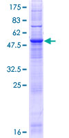 ab162923 on a 12.5% SDS-PAGE stained with Coomassie Blue.