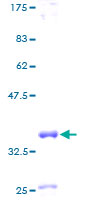 ab158141 on a 12.5% SDS-PAGE stained with Coomassie Blue.