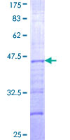ab161460 on a 12.5% SDS-PAGE stained with Coomassie Blue.