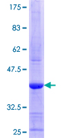 ab161461 on a 12.5% SDS-PAGE stained with Coomassie Blue.