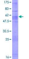 ab160636 on a 12.5% SDS-PAGE stained with Coomassie Blue.