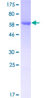 ab161521 on a 12.5% SDS-PAGE stained with Coomassie Blue.