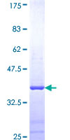 ab158138 on a 12.5% SDS-PAGE stained with Coomassie Blue.