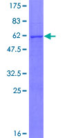 ab163270 on a 12.5% SDS-PAGE stained with Coomassie Blue.