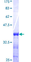 ab165315 on a 12.5% SDS-PAGE stained with Coomassie Blue.