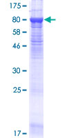 ab158148 on a 12.5% SDS-PAGE stained with Coomassie Blue.