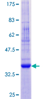 ab160859 on a 12.5% SDS-PAGE stained with Coomassie Blue.