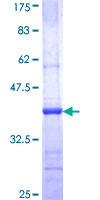 ab160906 on a 12.5% SDS-PAGE stained with Coomassie Blue.