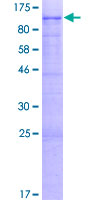 ab161834 on a 12.5% SDS-PAGE stained with Coomassie Blue.