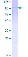 ab159006 on a 12.5% SDS-PAGE stained with Coomassie Blue.