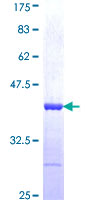 ab159007 on a 12.5% SDS-PAGE stained with Coomassie Blue.