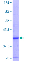 ab159008 on a 12.5% SDS-PAGE stained with Coomassie Blue.