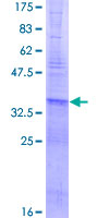 ab163559 on a 12.5% SDS-PAGE stained with Coomassie Blue.