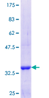ab163560 on a 12.5% SDS-PAGE stained with Coomassie Blue.