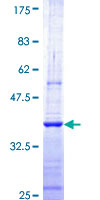 ab162247 on a 12.5% SDS-PAGE stained with Coomassie Blue.