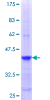 ab160438 on a 12.5% SDS-PAGE stained with Coomassie Blue.