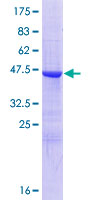 ab160948 on a 12.5% SDS-PAGE stained with Coomassie Blue.