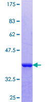 ab160949 on a 12.5% SDS-PAGE stained with Coomassie Blue.