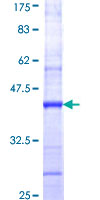ab158151 on a 12.5% SDS-PAGE stained with Coomassie Blue.