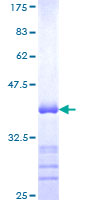 ab164759 on a 12.5% SDS-PAGE stained with Coomassie Blue.