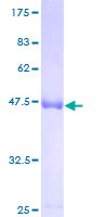 ab164267 on a 12.5% SDS-PAGE stained with Coomassie Blue.