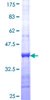 ab164268 on a 12.5% SDS-PAGE stained with Coomassie Blue.
