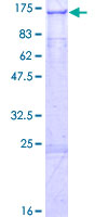ab160464 on a 12.5% SDS-PAGE stained with Coomassie Blue.