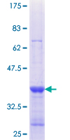 ab160465 on a 12.5% SDS-PAGE stained with Coomassie Blue.
