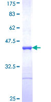 ab161426 on a 12.5% SDS-PAGE stained with Coomassie Blue.